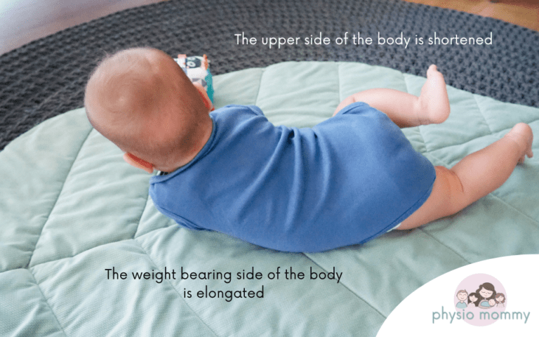 Asymmetry in Infants — 3 Things Worth Noting - Physiomommy