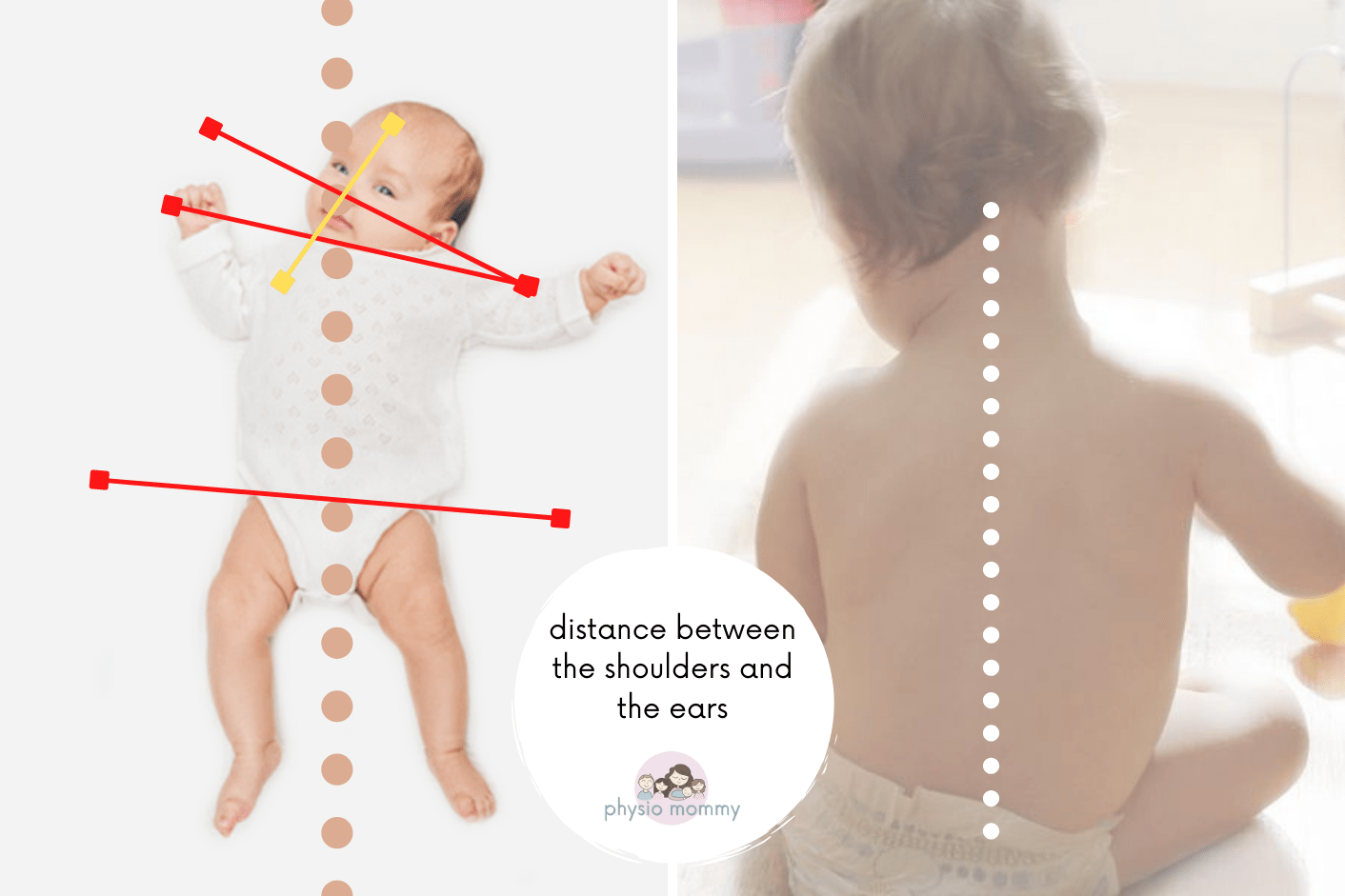 Asymmetry in Infants — 3 Things Worth Noting - Physiomommy
